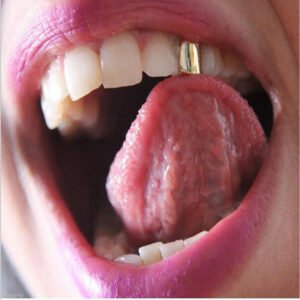 grillz