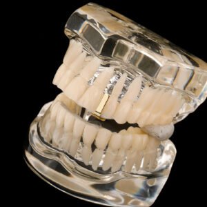 Smooth Vertical Bar Grillz